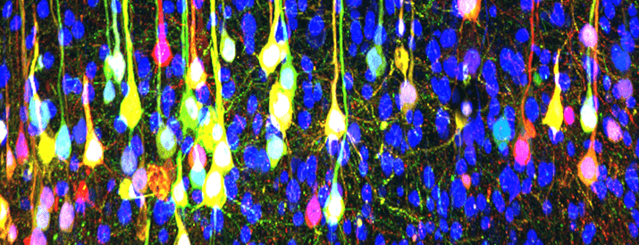 This image uses viral tracing to map connected neurons.